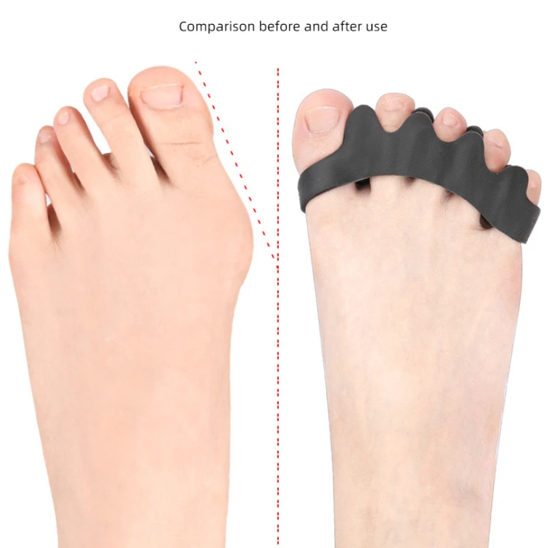 1Pair Gel Hammer Toe Straighten Silicone Separators Corrector Splitter Protector Thumb Valgus Bunion Adjuster Foot Pain Relief