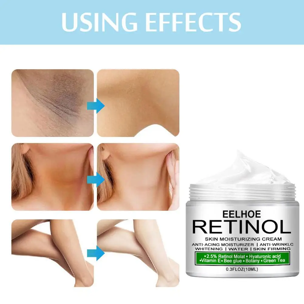 Crema al retinolo glutei del ginocchio sotto le ascelle candeggina privata rimuovi la pigmentazione migliora il opaco illumina la cura della pelle sbiancante