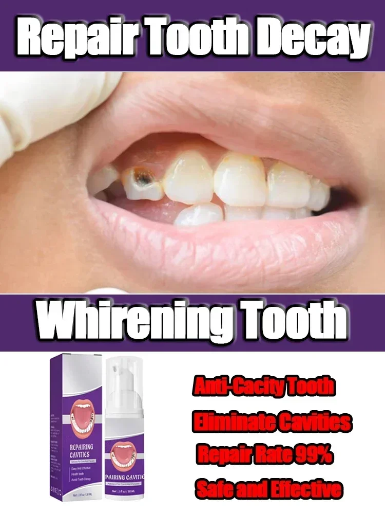 7 Effective Teeth Whitening Tooth decay repair  Calculus Plaque Periodontitis Remove Cavities