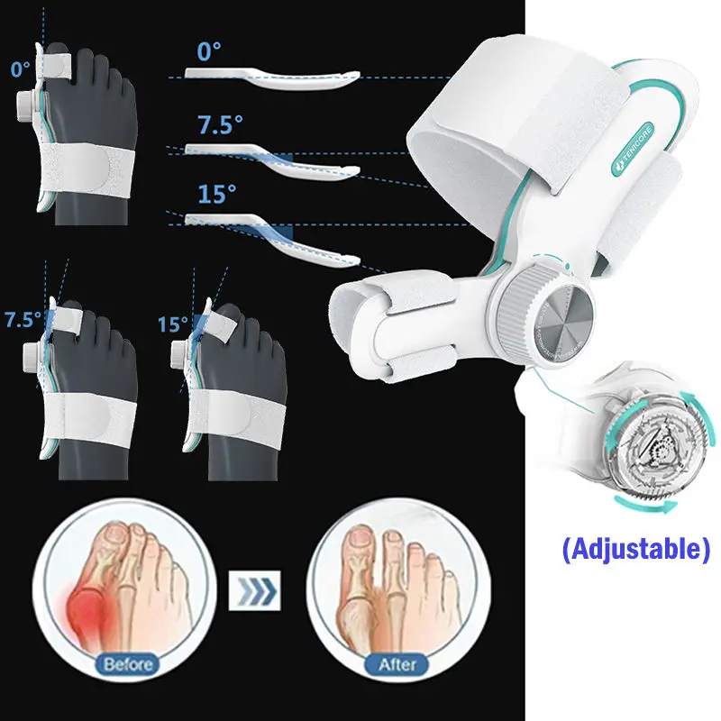 

3D Hallux Valgus Correction Adjustable Foot Bunion Toe Corrector Treatment Hammer Toe 180° Joint Movable Foot Care Day And Night