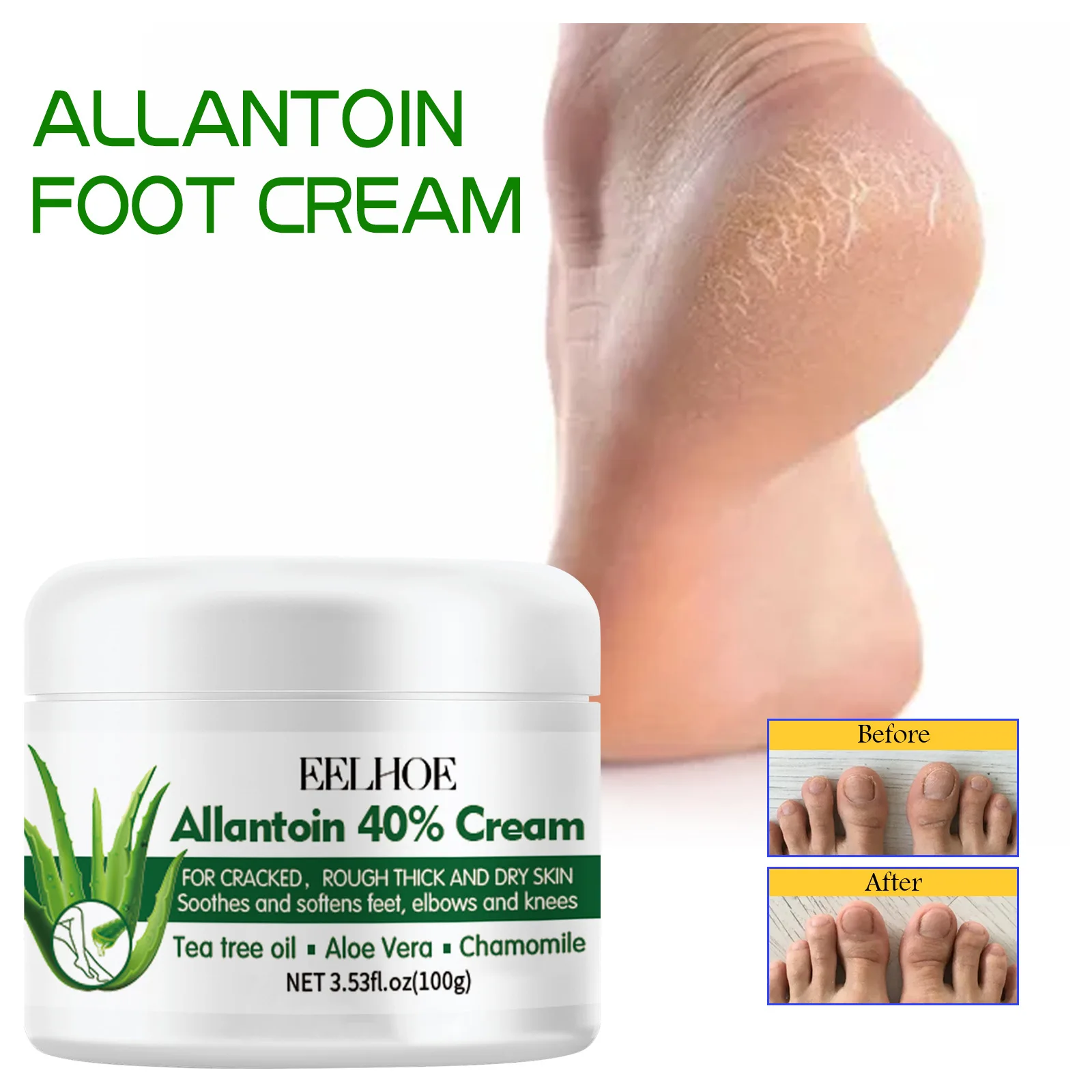 Foot Anti Dry Crack Cream(200g In Total)