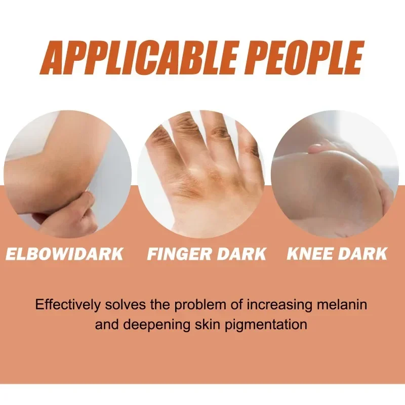

Sdotter New Acanthus nigricans essence oil Knuckle armpit Knee joint whitening skin Improve Dull fade Dark spots Melanin brighte