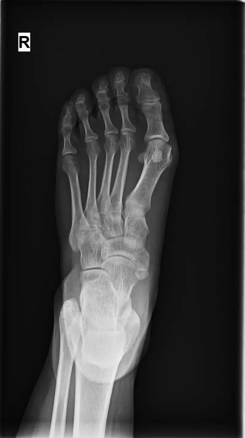 thumb