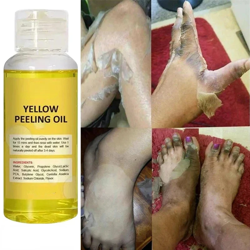 Huile de Peeling Jaune Expensante, Soins du Corps, Blanchiment Rapide à 100%, Biologique Wiltshire, Sérum pour Peau Douce et Foncée, Cosmétiques Coréens