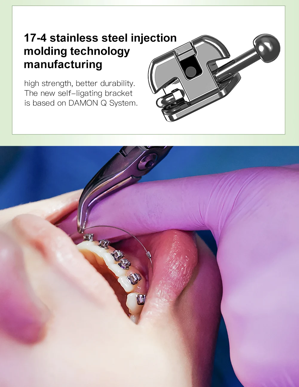 AZDENT Zahnspangen, kieferorthopädische Brackets, selbstligierend, mit bukkaler Röhre, markierter Basis, Roth MBT 0,022, bewegliche Haken 345, inklusive Werkzeug. – Detail 5