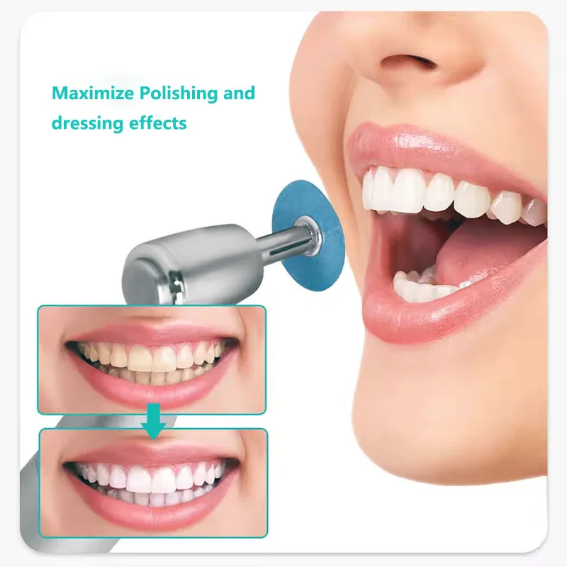 Disques de polissage dentaire, mandrin de tige de maintien, disque flexible Soflex, tige RA, matériel de blanchiment des dents, outils de dentisterie, consommables, 40 pièces