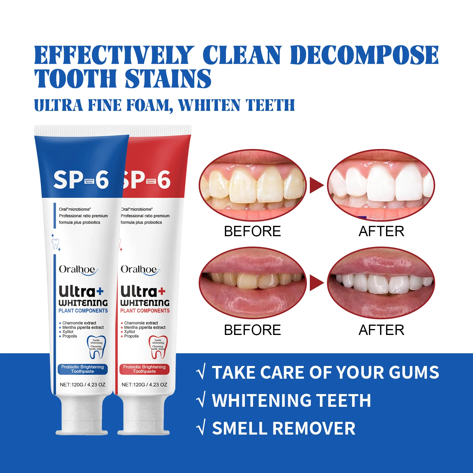 

Teeth Whitening Toothpaste Remove Plaque Tartar Stains Oral Hygiene Cleaning Dental Bleaching Tools Sp 6 Probiotic Toothpaste