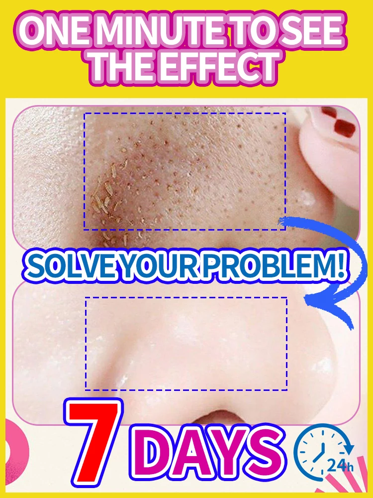 

Solve Large Pore Problems