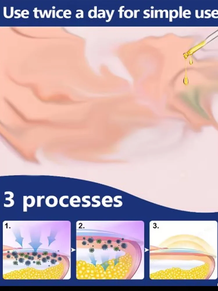 Nail Cleaning Tools, Blue Light Laser Tools Root Repair Upgraded to Second Generation 26