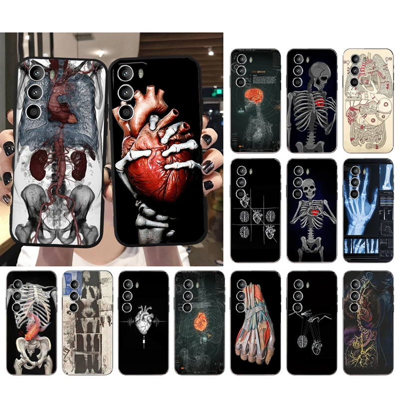 Human Organs Skeleton Skull Brain Case For Moto G84 G22 G32 G34 G52 G10 G20 G30 G60 G60S G13 G50 G54 G62 G53 G72 G85 G24 Power