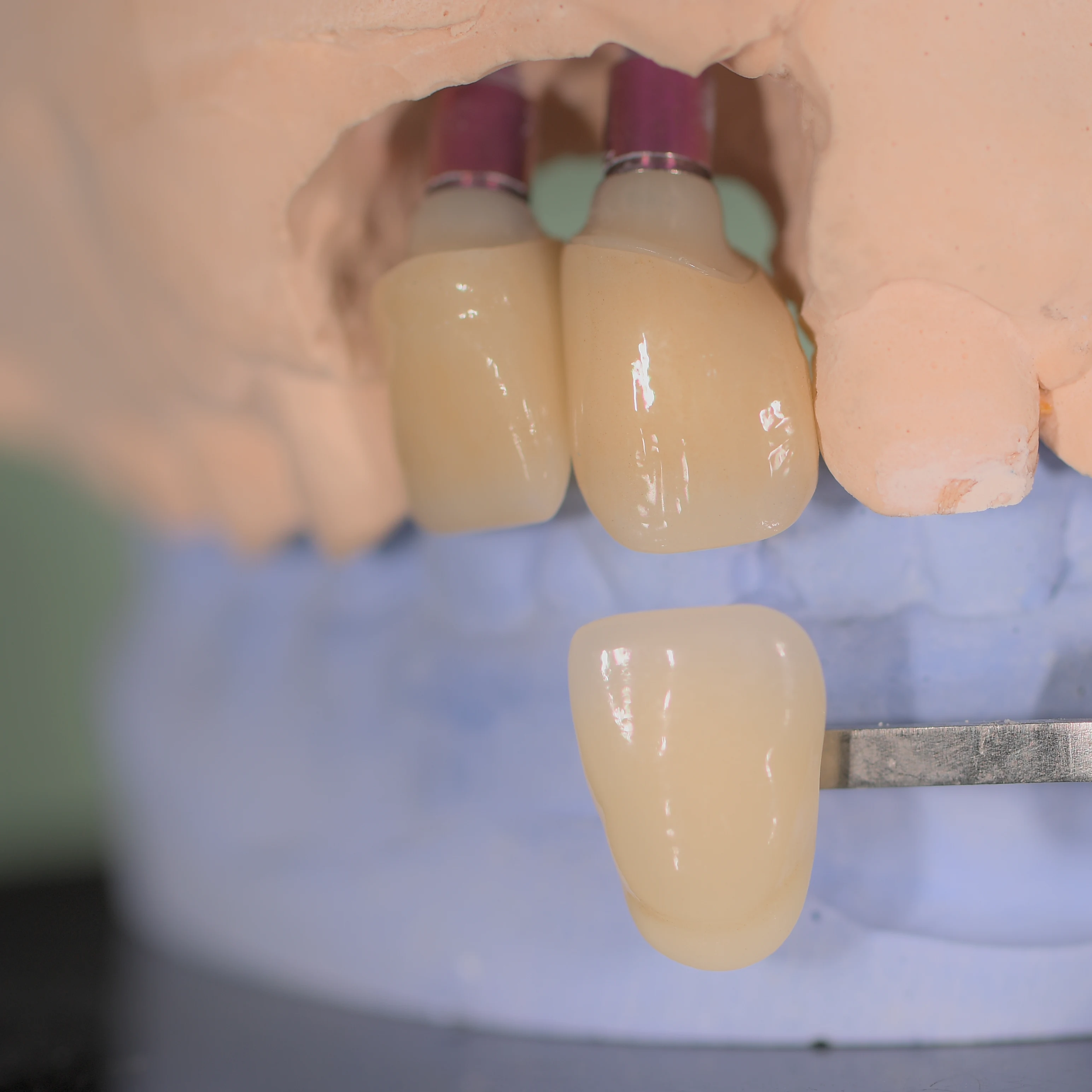 Mostek dentystyczny z cyrkonu 3DPro wielowarstwowe 98mm materiały naprawcze do protez Super przezierność