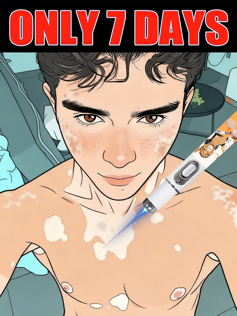 

Blue light pen quickly removes vitiligo, a best-selling vitiligo care tool