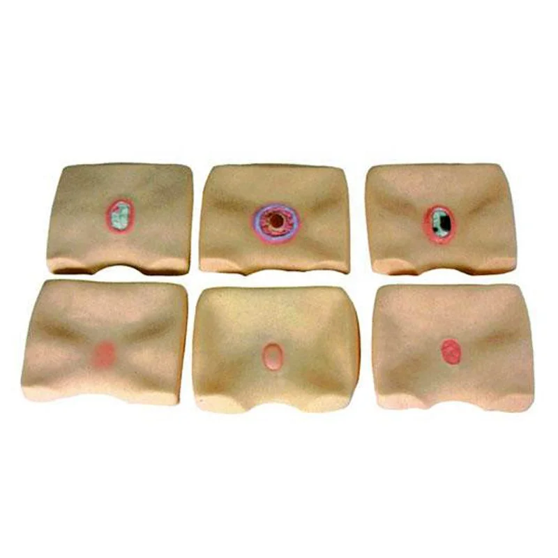 

unique Buttock Skin Decubitus Ulcers Simulator, Nursing Pressure Sores Model