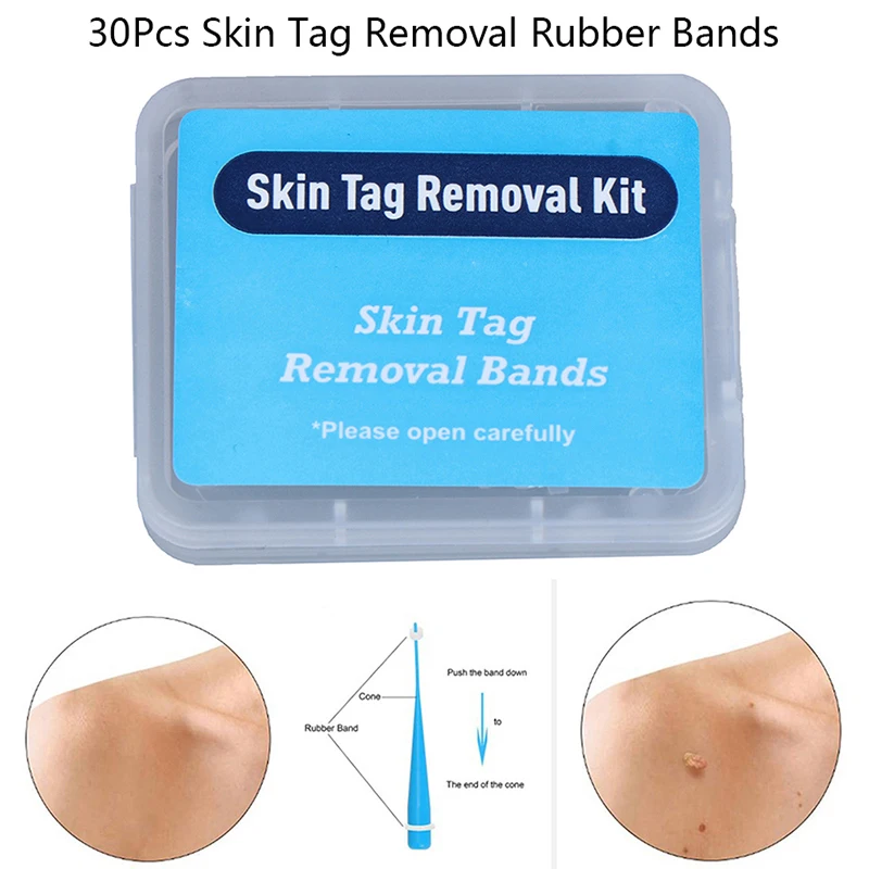 30pcs/pack Skin Tag Removal Rubber Bands Micro Band Non Toxic Face Care Mole Wart Skin Care Tools