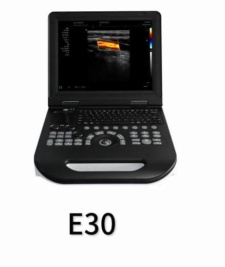 Portable color ultrasound E30 with abdominal convex array probe