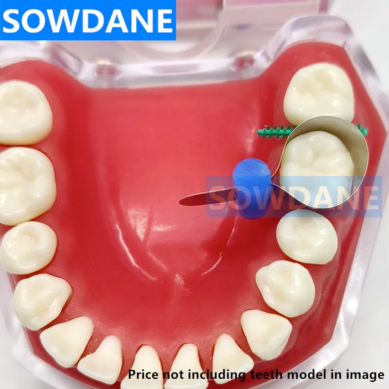 ฟันโลหะMatrix Bands Retainerless Automatrixพร้อมLocker Dental Matrixเมทริกซ์ตัดโค้งเมทริกซ์