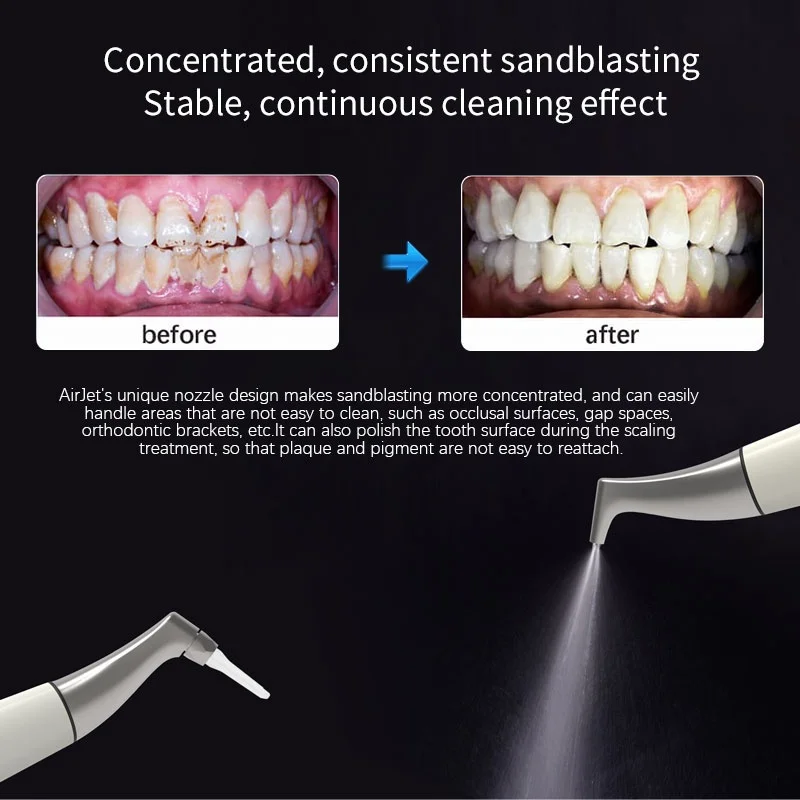

Dental Air Polisher Machine, Supragingival & Subgingival Sandblasting Handpiece for Teeth Polishing