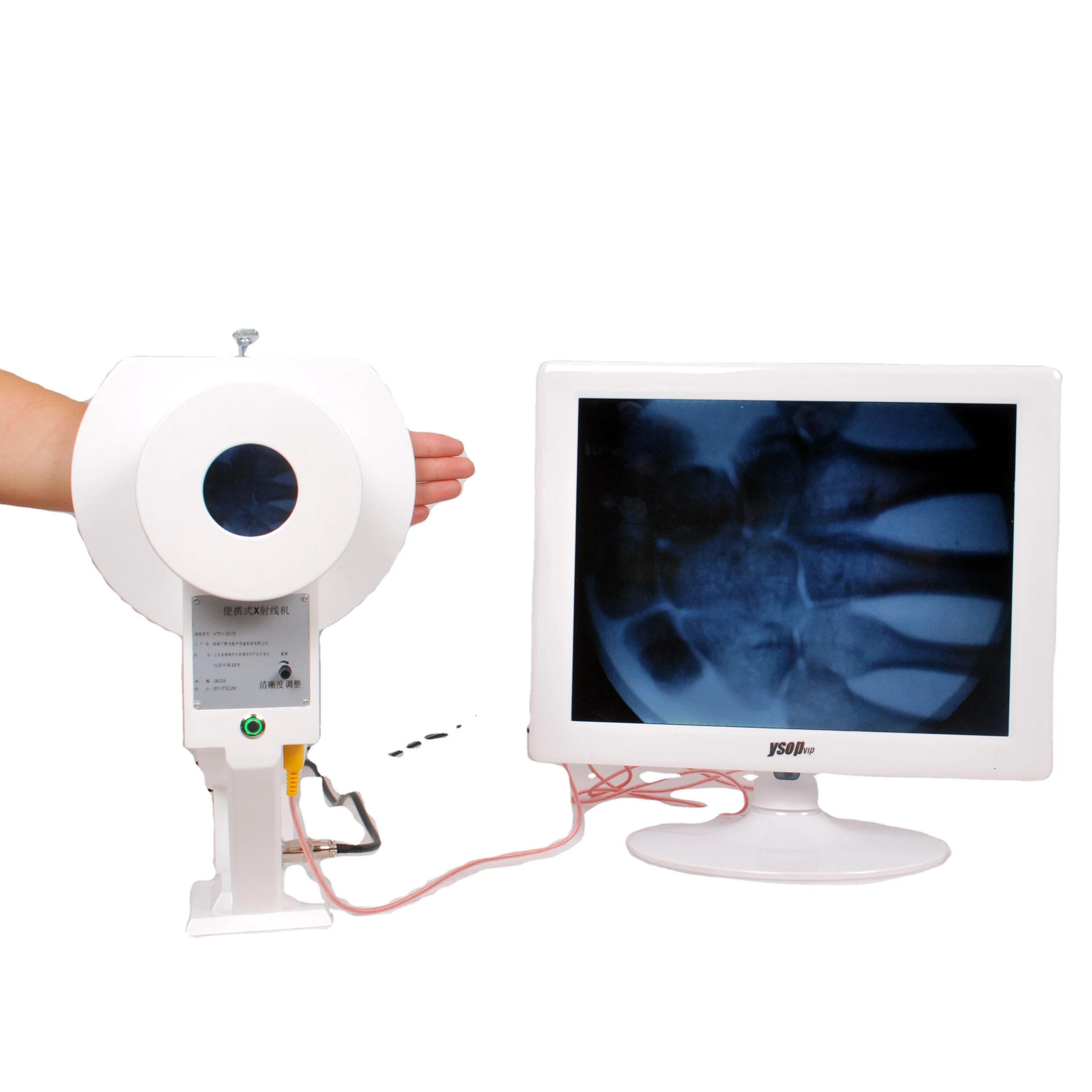 

Medical X-ray fluoroscopic machine for radiology