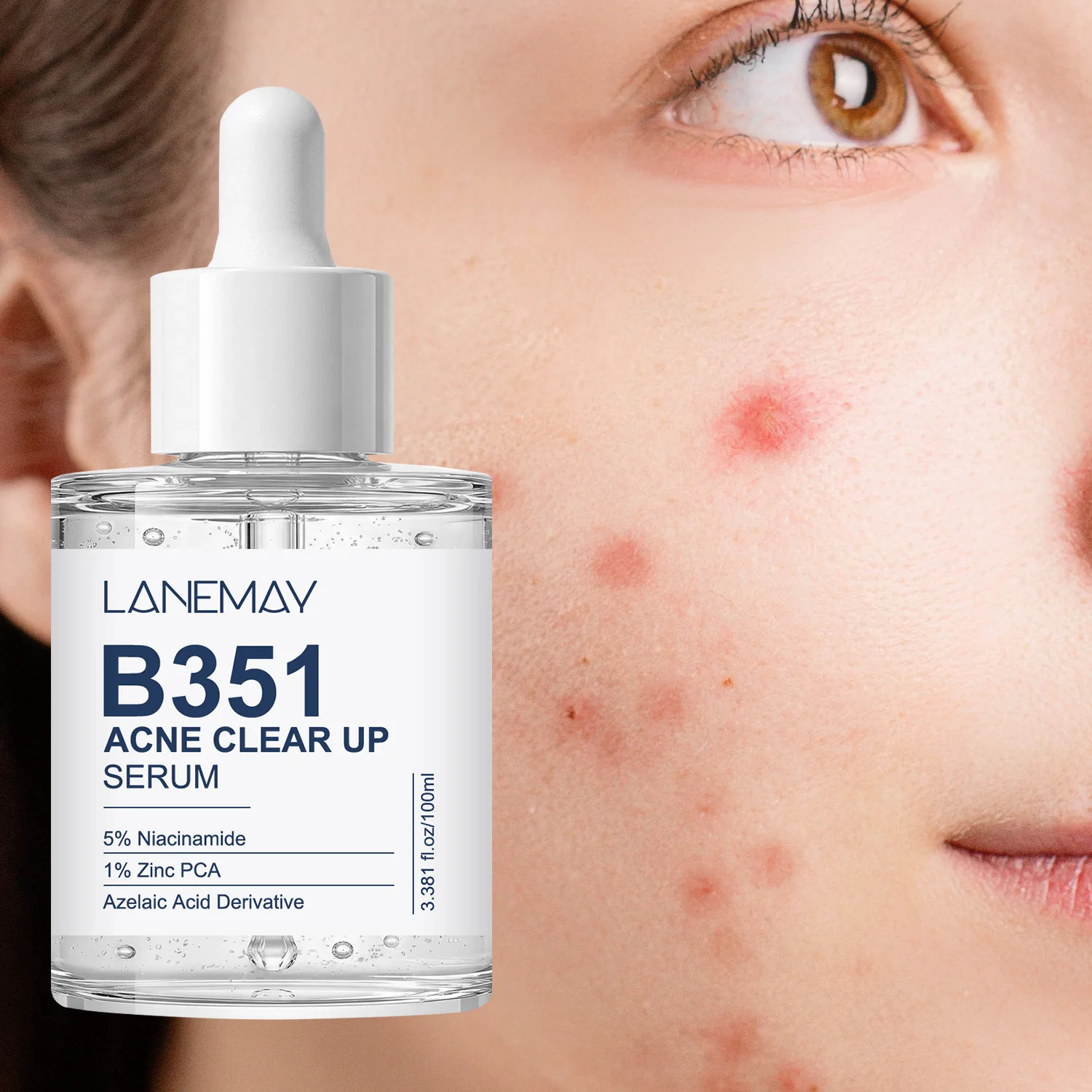 B351 Acne Clear Up Serum – 5% Niacinamide 1% Zinc PCA for Clearing Breakouts, Fading Closed Comedones, Deeply Hydrating.