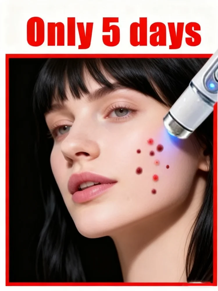 

4th ᵍᵉⁿᵉʳᵃᵗⁱᵒⁿ ᵘᵖᵍʳᵃᵈᵉᵈ wᵃʳᵗ ⸴ ʳᵉpᵃⁱʳ wᵃʳᵗˢ ʳᵒoᵗ ⸴ ᑫᵘⁱᶜᵏˡʸ