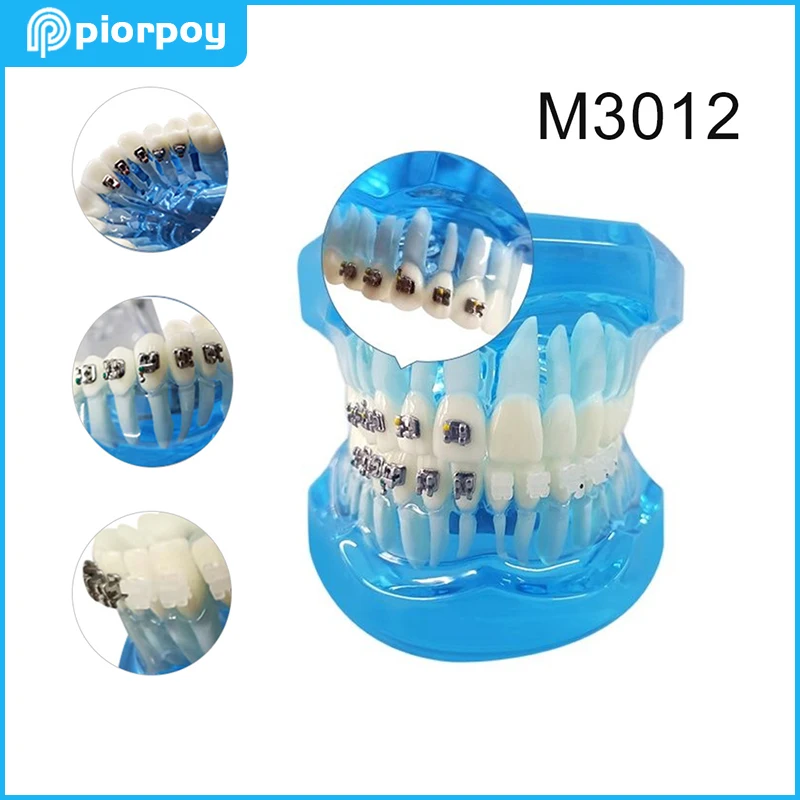 

Dental Teeth Model Orthodontic Four Brackets comparison for Demonstration Odontologia Education Teaching Mold Students Training