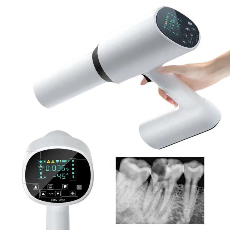 Original Ai Ray Mini Touch ScreenX Ray  Constant DC X-Ray Machine  Imaging System