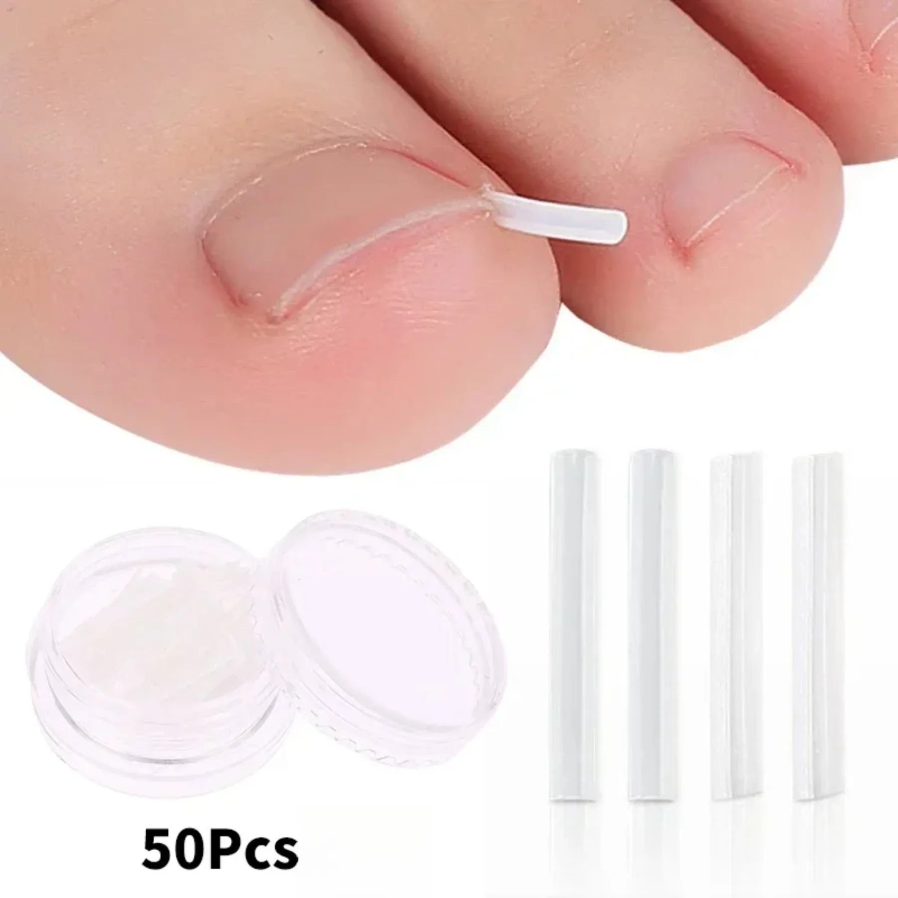 50 Piezas de Herramienta para Uñas Encarnadas, Tratamiento para Uñas Encarnadas, Parche Elástico Adhesivo, Clip de Enderezamiento, Herramienta de Pedicura