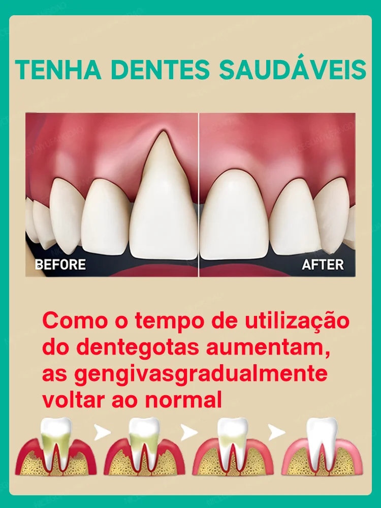 Aliviar Rapidamente A Dor De Dente, Reparar Gomas Danificadas, Gomas De Goma Saudáveis