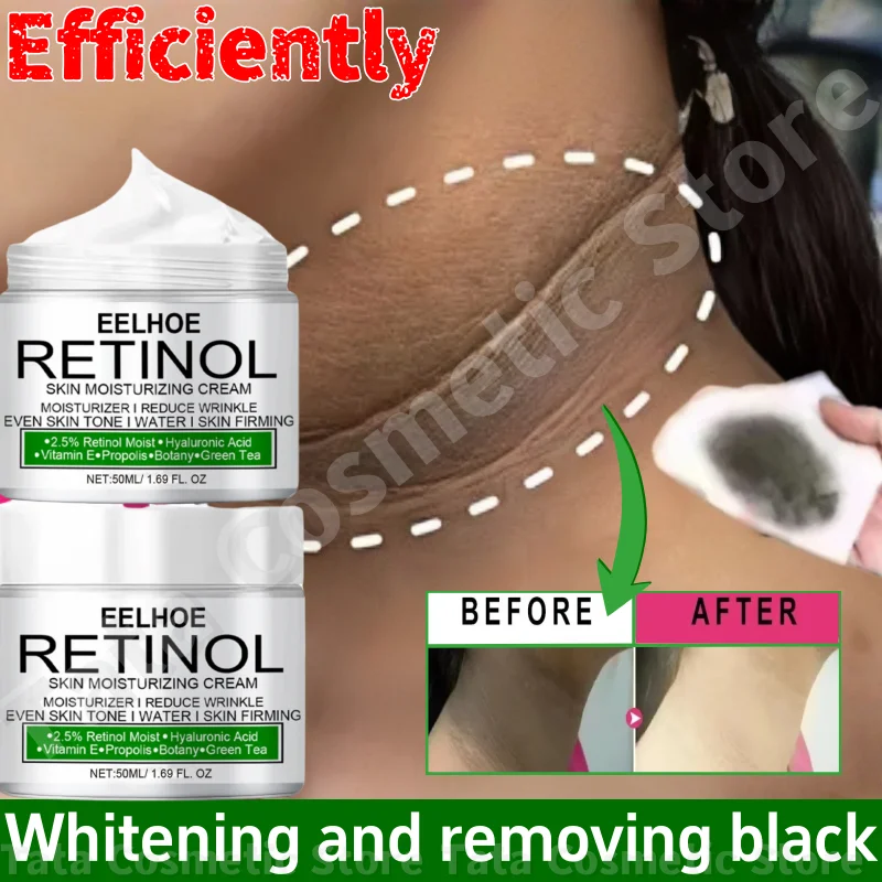 

Body Whitening Cream Dark Skin Armpit Lightening Intimate Areas Underarm Bleaching Private Parts Whiten Cream Body Lotion Beauty