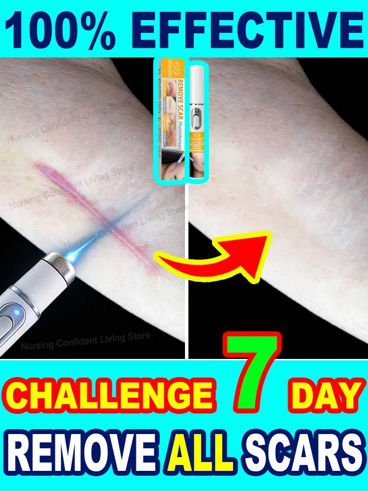 No scars, smooth skin