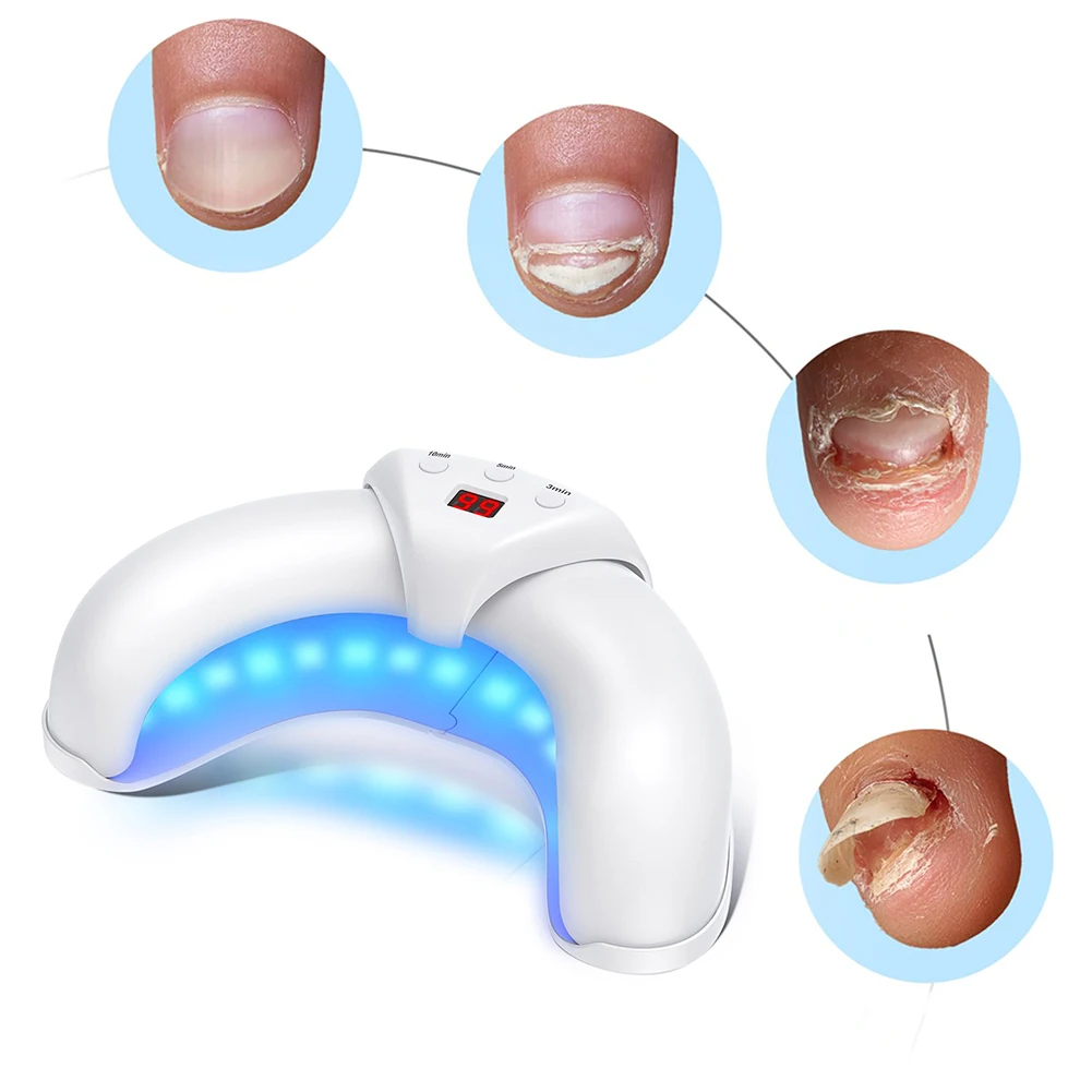 

Nail Fungal Light Device Nail Fungal Cleaning Device Rechargeable Toenail Fungal Cleaning Machine for Nail Fungal Infections