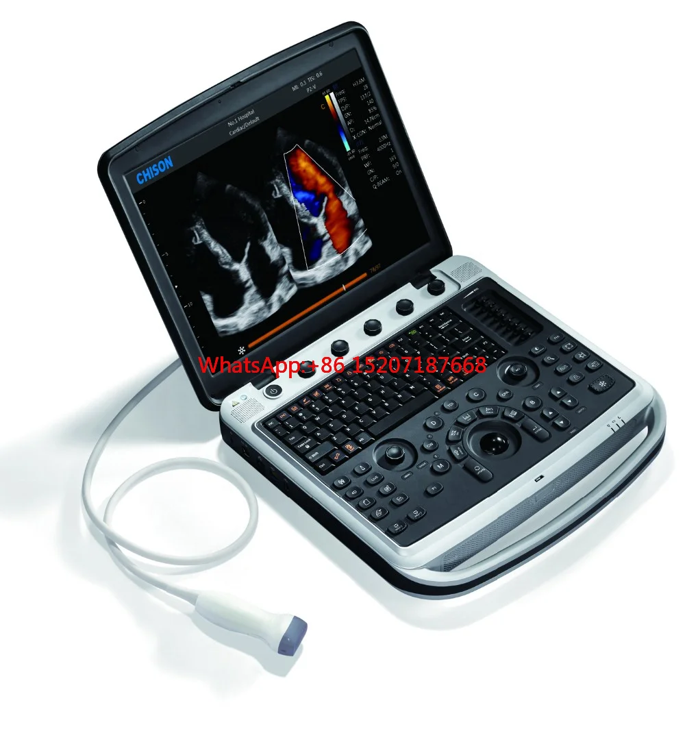 

Portable Vet B Scanner LED Veterinary Ultrasound Machine