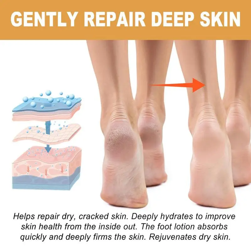 30ml Foot Callus Remover Spray Quickly Soften Calluses Exfoliation Dry Feet Skin Hydrating Foot Dead Skin Spray Foot Care