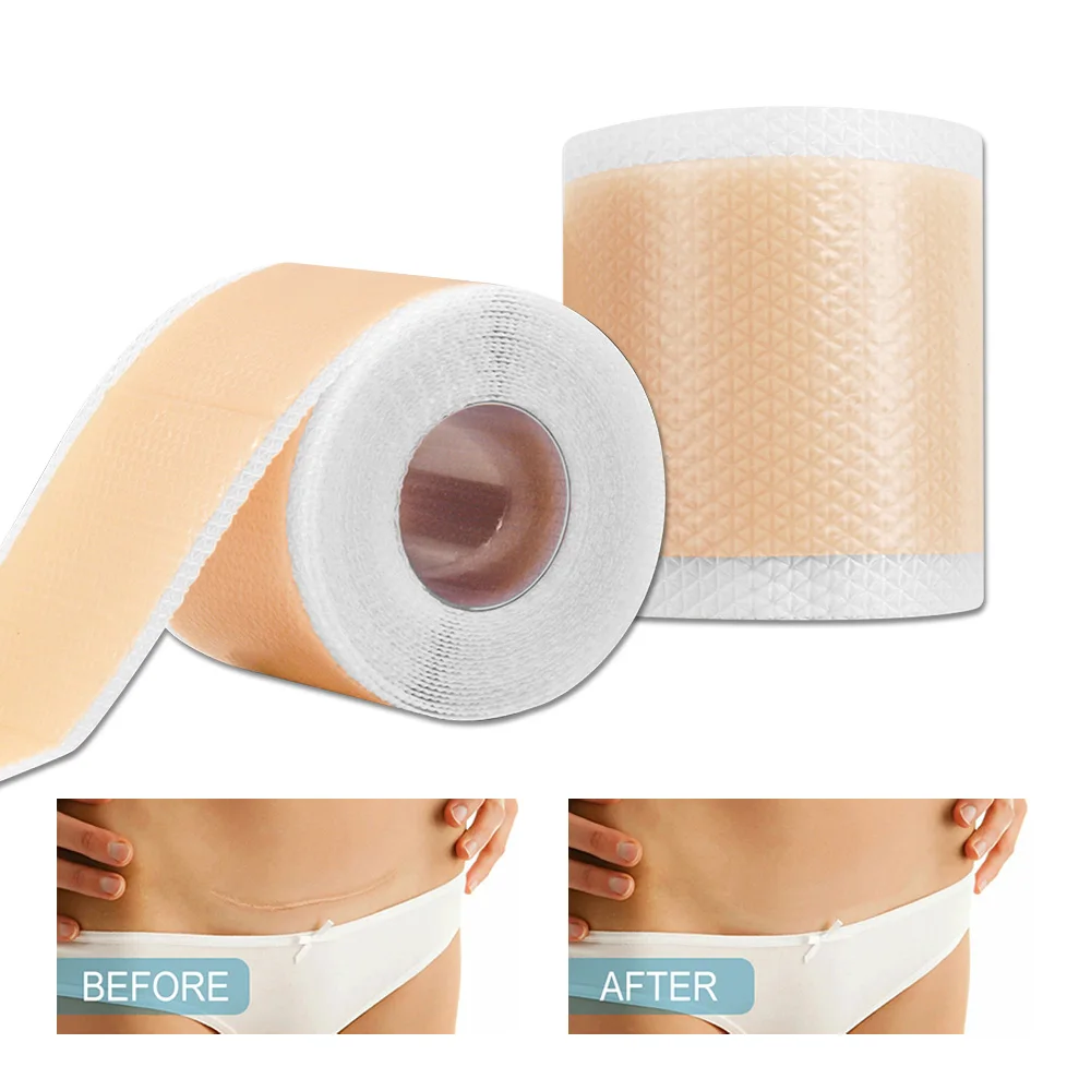 

1 рулон профессиональных силиконовых листов для лечения шрамов — многоразовые силиконовые полоски для шрамов для Keloid, C-Section, хирургии, спины