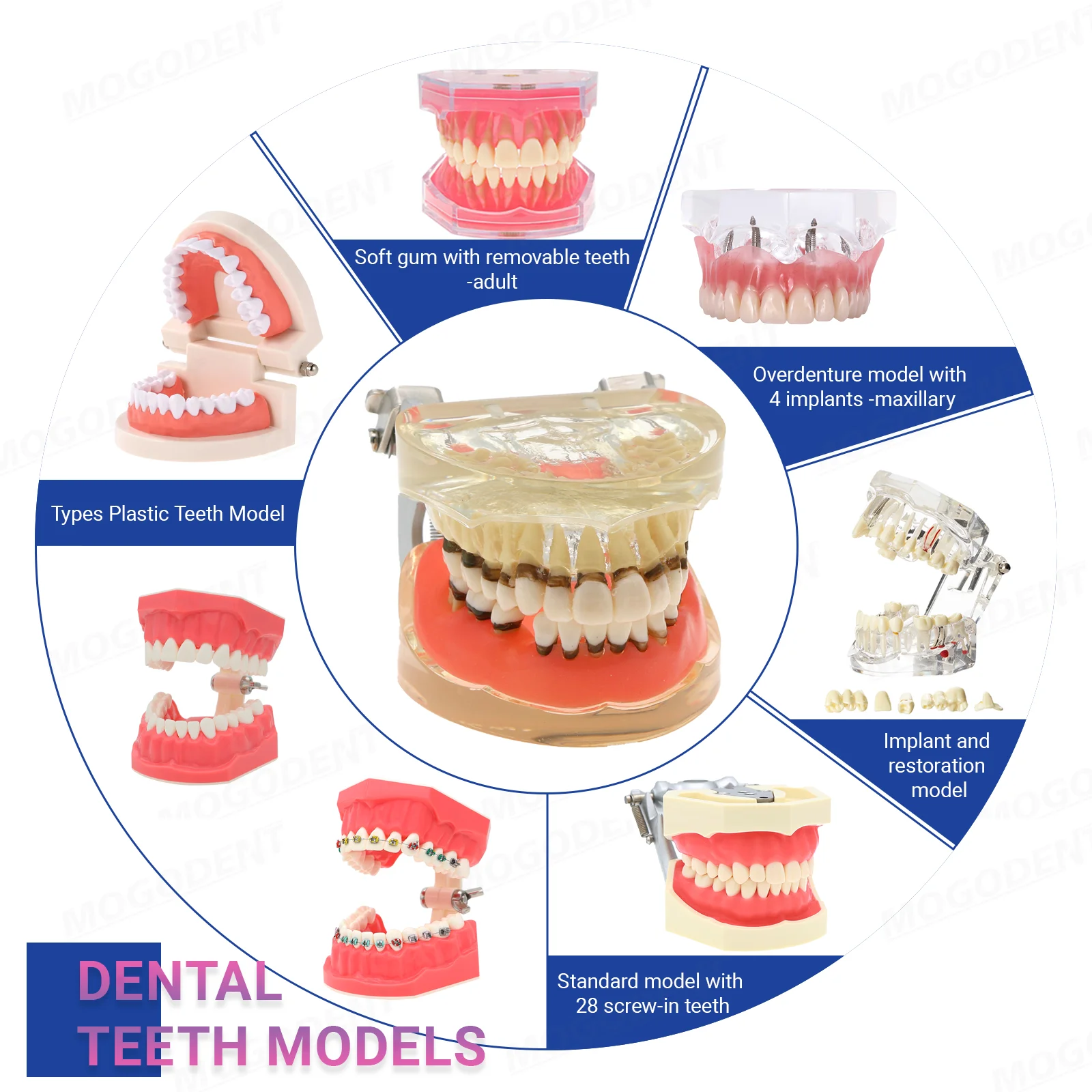 

Dental Implant And Restoration Model Dental Teaching Model Teeth Models Dentistry Products For Training Studying