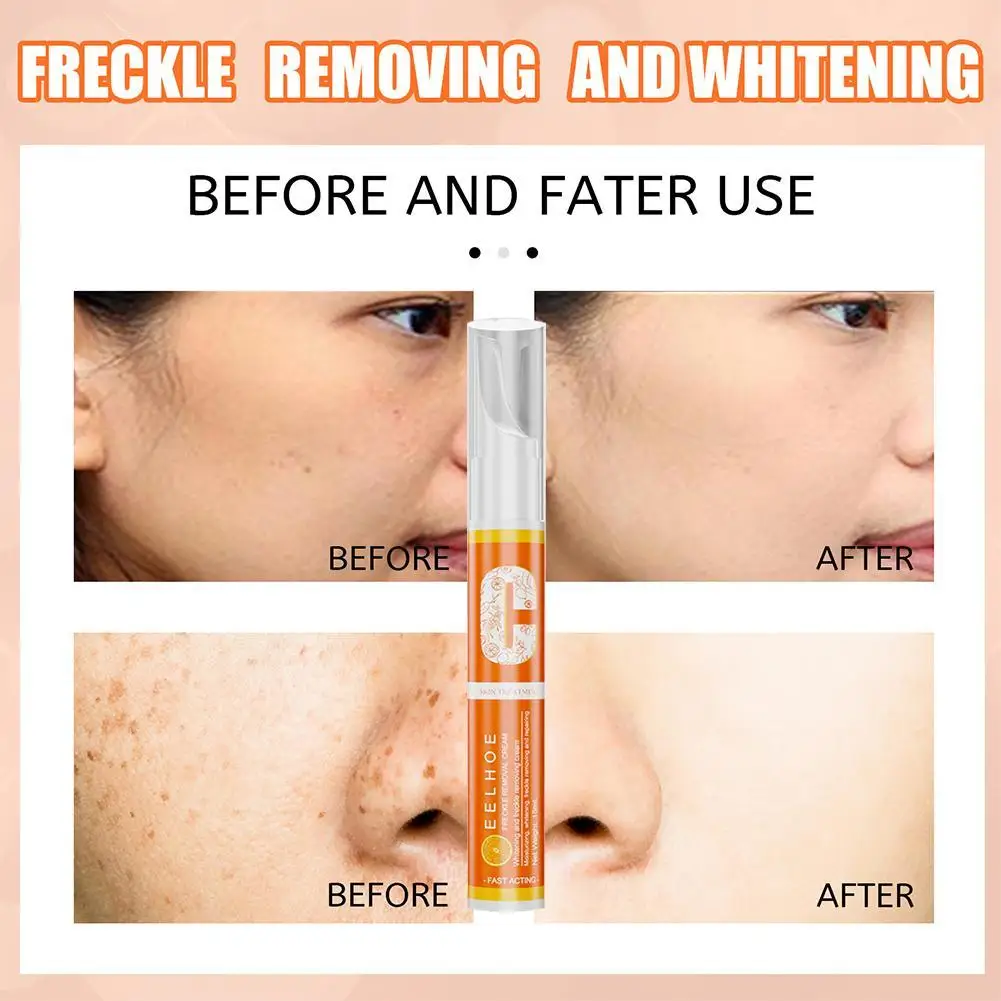 New VC Fade Pen Vitamin C Instant Spot Removal Gel Pen Spots Removal Spot Whitening Pigment Effective Freckles Y5G7