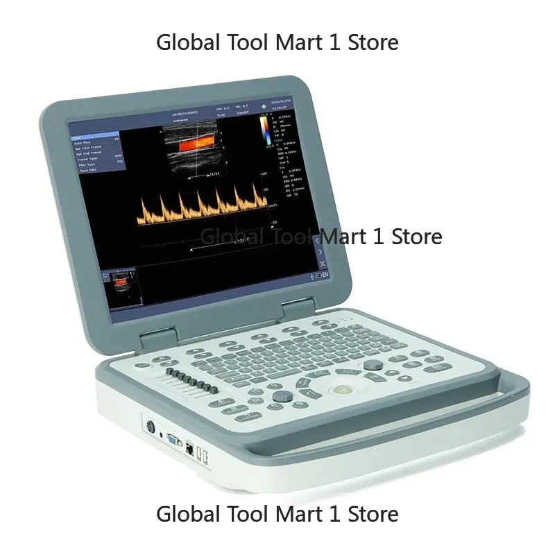 Special Color Notebook B Ultras-ound Machine for Animal Hospitals Economical Ve-erinary Diagnostic Equipment