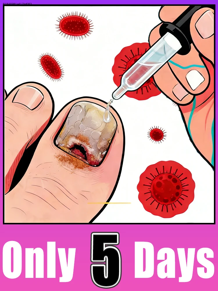 

Bʀᴇᴀᴋ ғʀᴇᴇ ғʀᴏᴍ ᴅʀʏ ᴄᴜᴛɪᴄʟᴇs, ғɪɴɢᴇʀᴛɪᴘs sᴛᴀʏ ᴍᴏɪsᴛ ᴀɴᴅ ɴᴏᴜʀɪsʜᴇᴅ