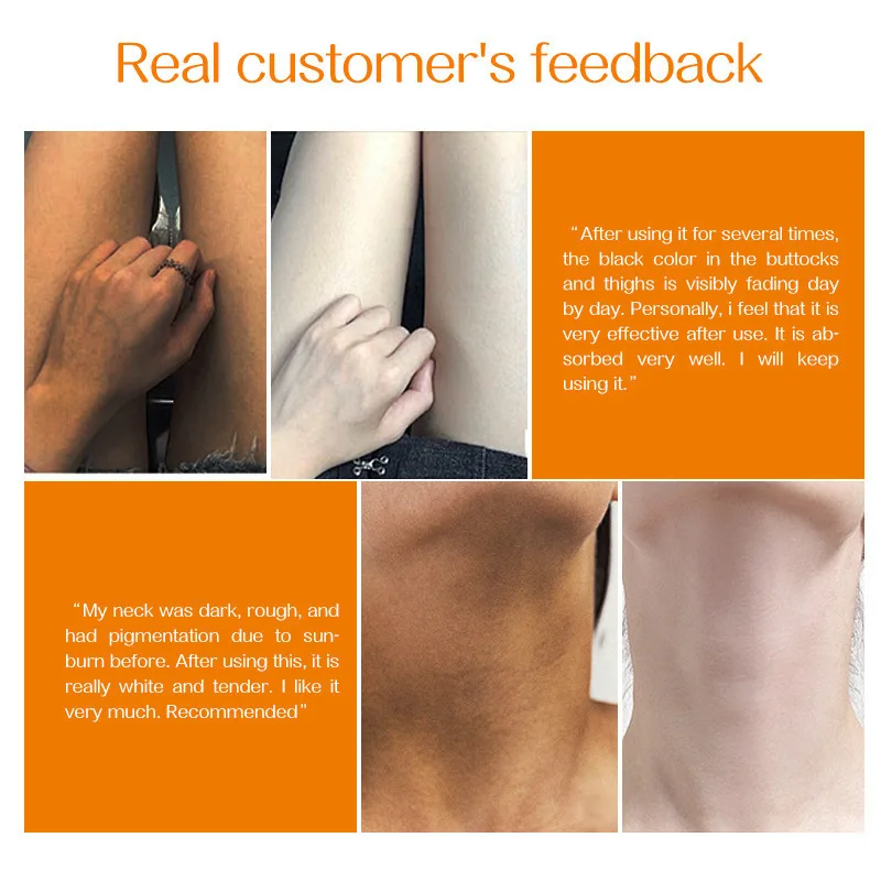 ビタミンC配合の脇の下美白クリーム、黒ずみケアで滑らかで明るい肌へ、栄養補給ボディケアフォーミュラ