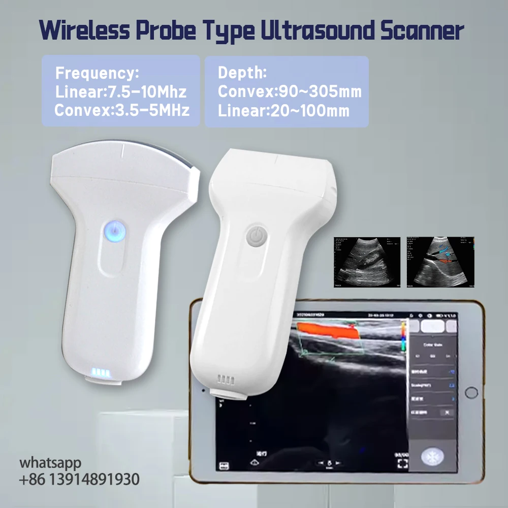 Phone/Pad/PC Compatible Ultrasound Probe WIFI Wireless & USB Cable 96 Elements Linear/Convex Easy to Operate