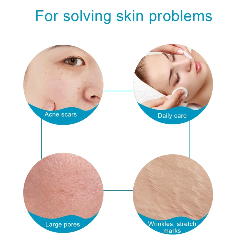 التيتانيوم ديرما الأسطوانة 0.2/0.25/0.3 مللي متر 540 دبابيس نمو الشعر اللحية إبرة مجهرية للوجه والجسم التجميل مايكرو الوجه لفة أداة