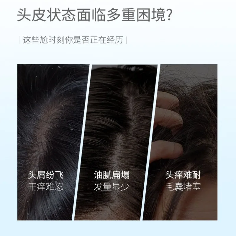 300ml Selenium Disulfide Anti Dandruff Shampoo Scalp Purifying Exfoliating Oil Control  Balancing, Volumizing