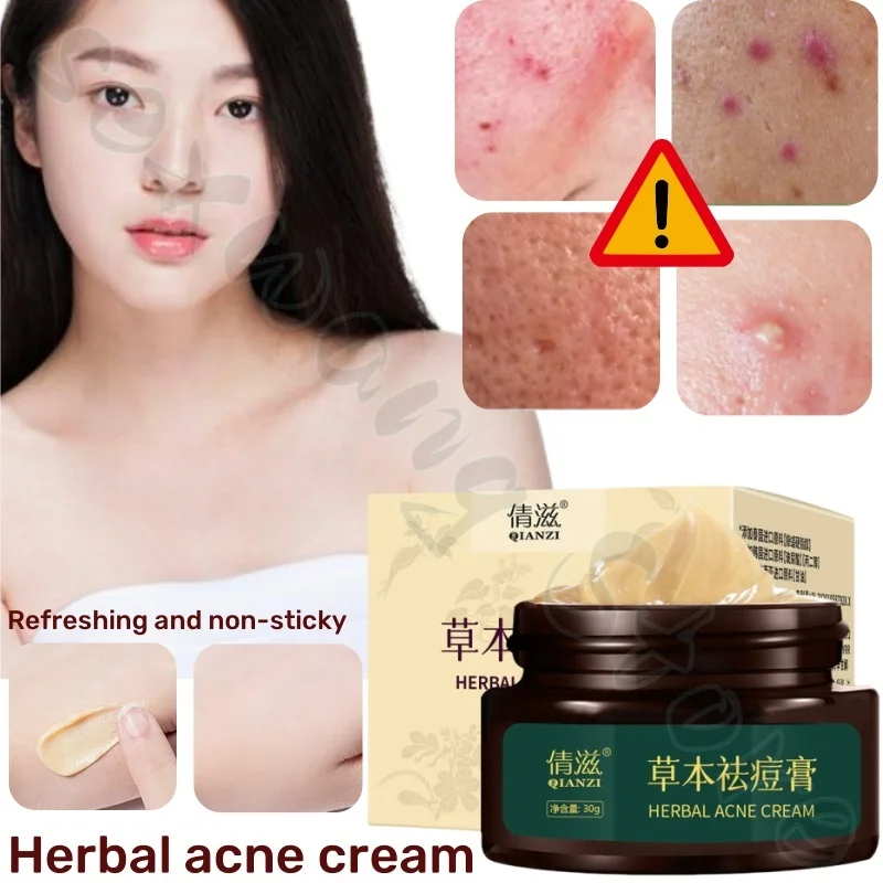 

Herbal medicine to fade acne marks 30g, hydrating and moisturizing, improving acne-prone skin, gentle and non-irritating