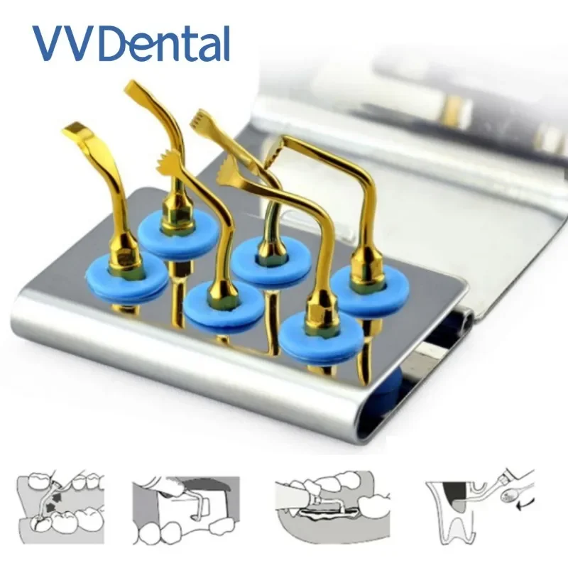 VV Dental Ultrasonic Surgery Bone Cutting Tip Kit WSBCK Dental Piezosurgery Tips Fit Woodpecker Mectron Ultrasurgery