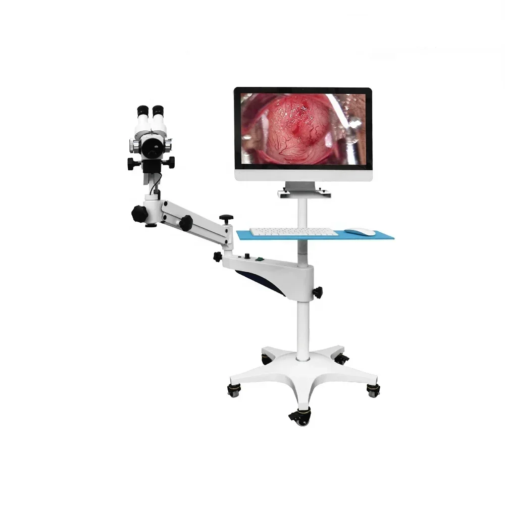 Hot sale Video colpo scope Medical Digital Video colpo scope Visual colpo scope