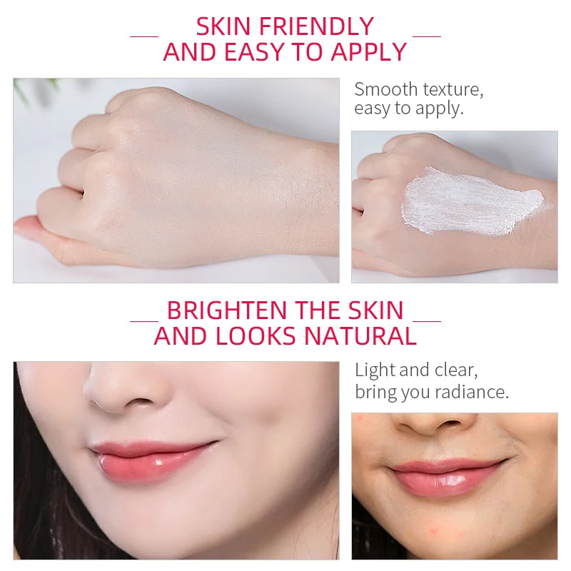 Whitening Freckle Cream Melasma Pigmentation Remove Nicotinamide Serum Cream Pores Refining Black Spot Acne Marks Removal Cream