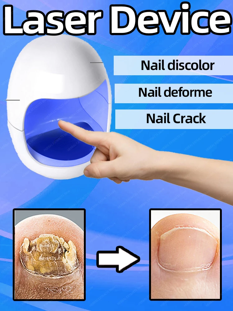 

For Solving Feet Nail