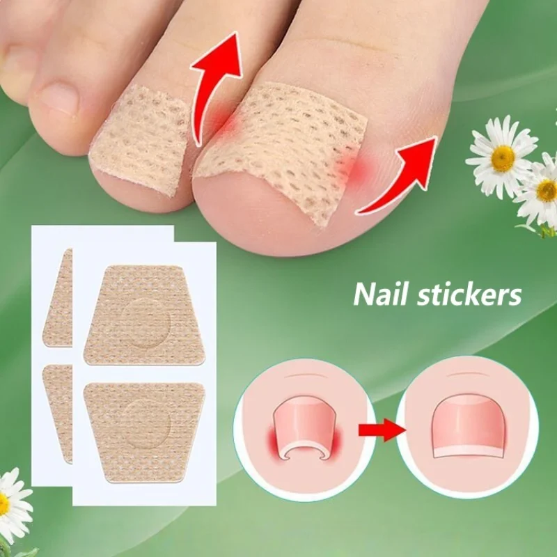 Professional Ingrown Toenail Corrector Patch Paronychia Care Sticker Nail Care Tape Household Foot Care Tool Toenail Maintenance