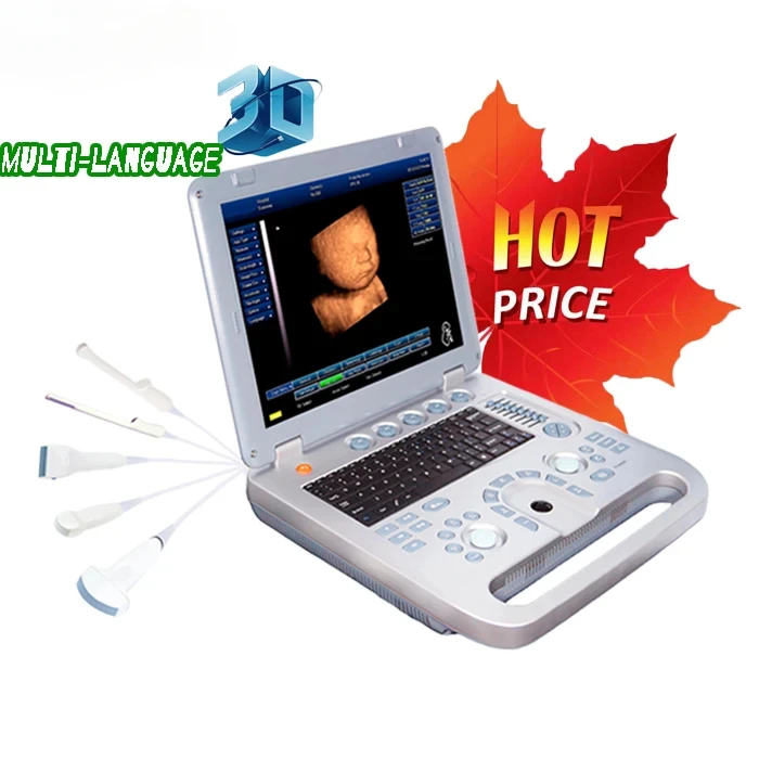 Best price SUN-800D laptop hospital color doppler ultrasound scanner 3D 4D ultrasound