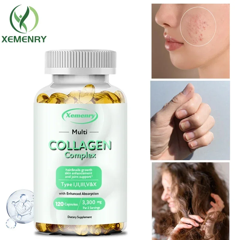 

Collagen Complex Capsules - Promotes Collagen Production, Supports Skin, Joint and Nail Health, Supports Overall Health